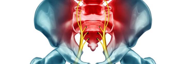 Chiropractic Austin TX What You Need To Know About Sciatica